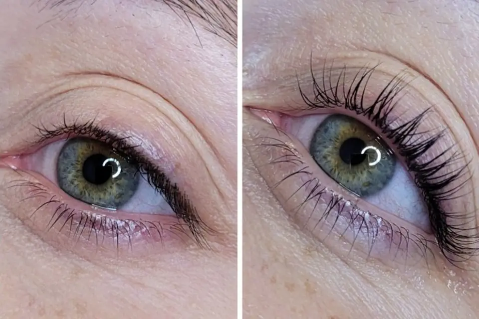 Sandra, beauté esthétique — photo 9