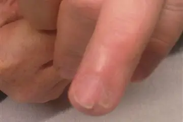 Lys Hermine — photo 3