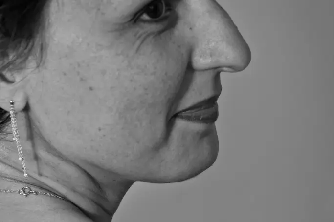 Yohan Tison — photo 3