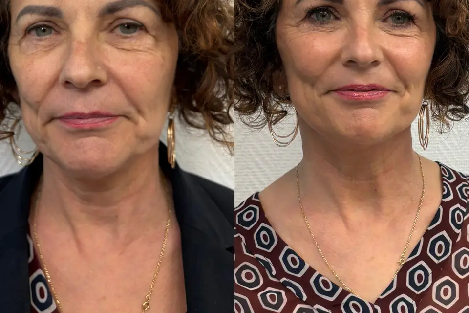 T’as le look Cloclo — photo 1