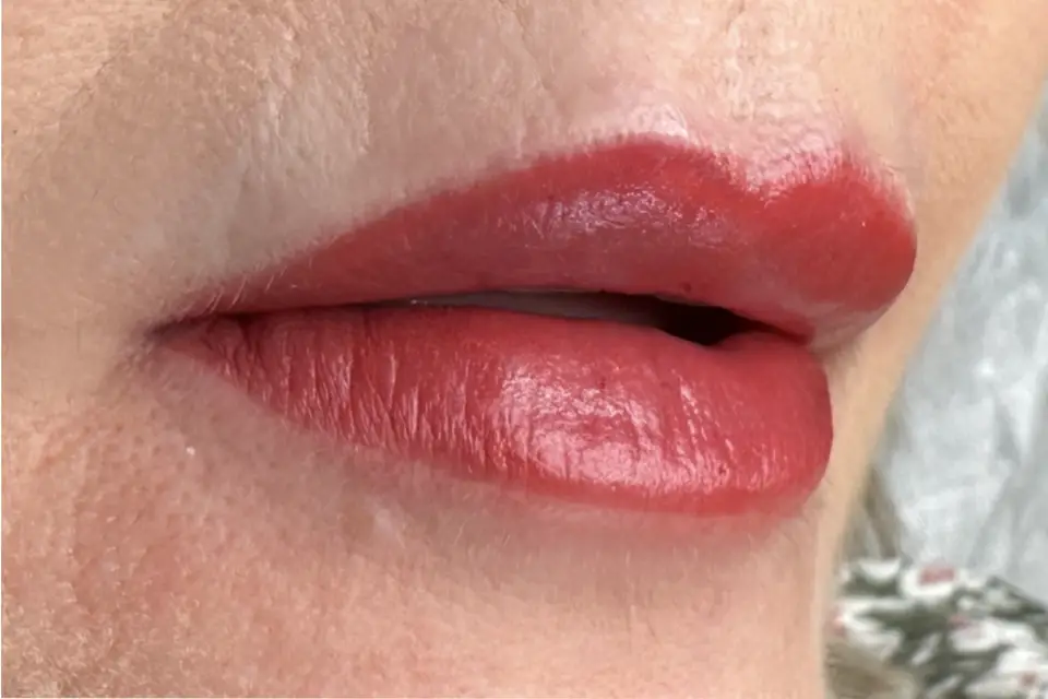 Chm Dermo — photo 1