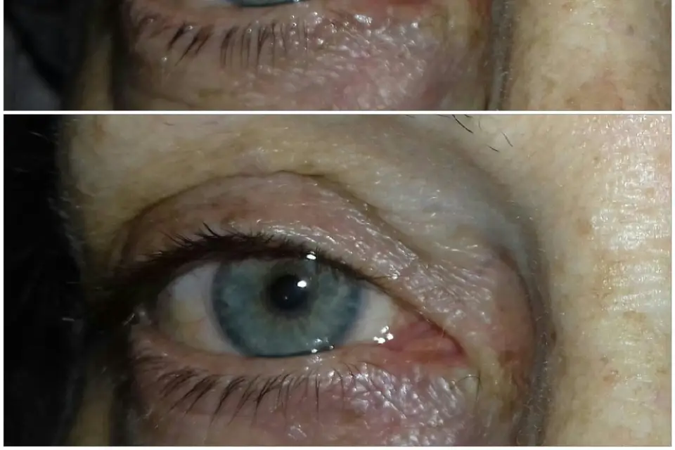 L'Histoire d'une Peau — photo 2