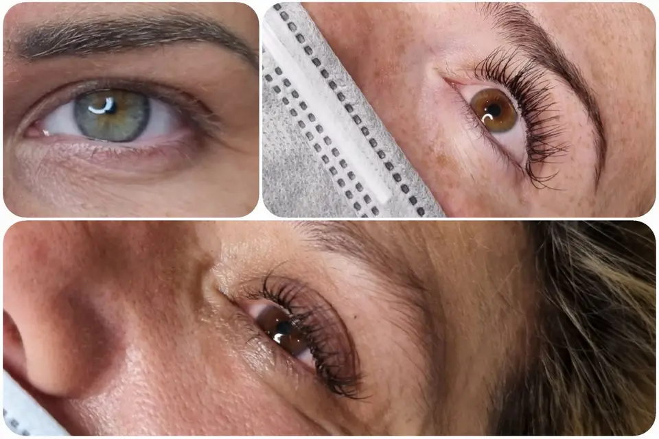 Edelweiss — photo 6