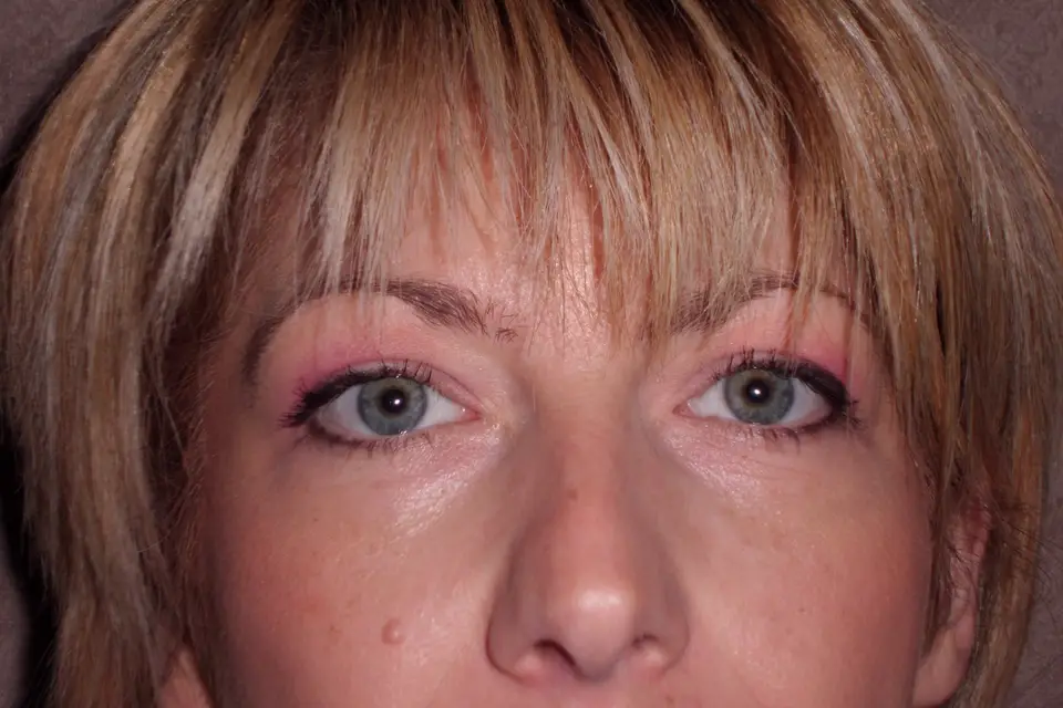 Beauté en Eveil — photo 3