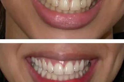 Bettynail's — photo 5