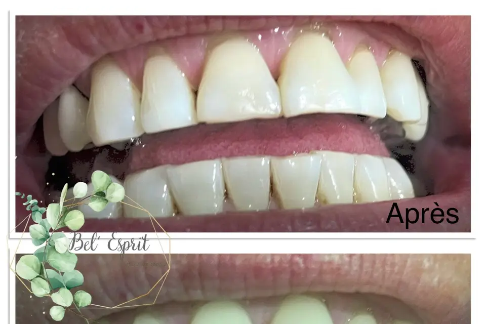 Bel’esprit — photo 5