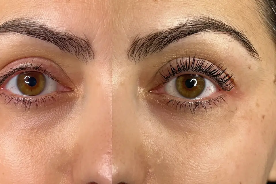 Pretty Little Eyes — photo 5