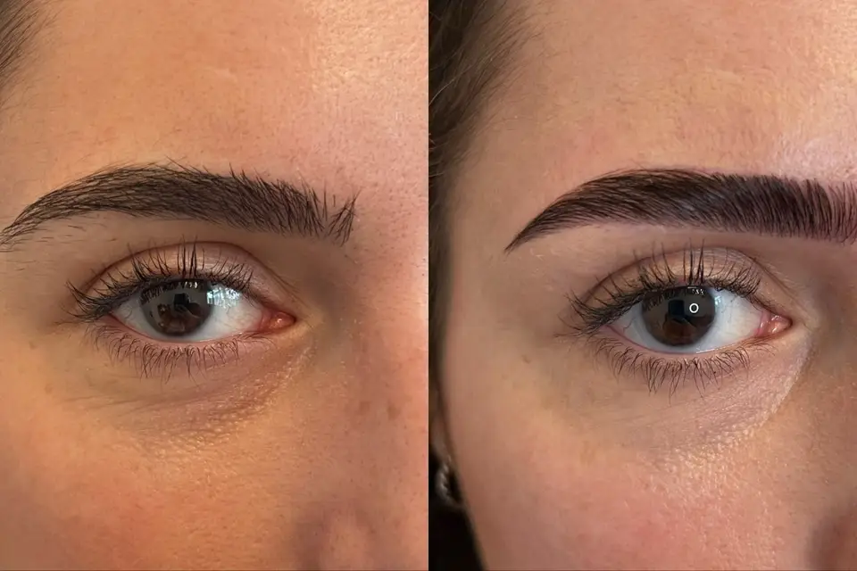 Pretty Little Eyes — photo 6