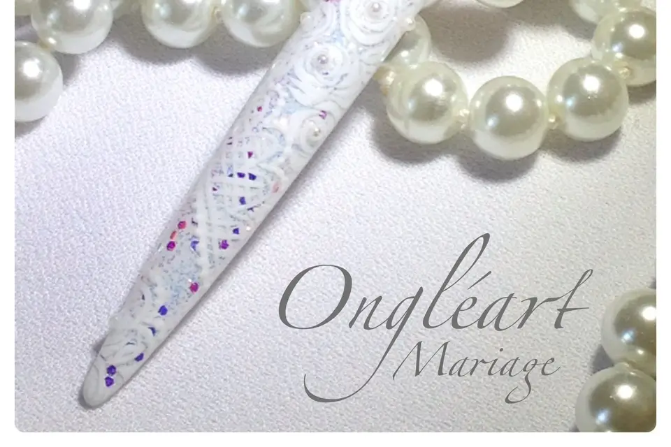 Ongléart — photo 5