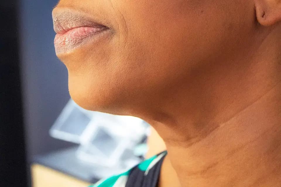 Libocorps — photo 2