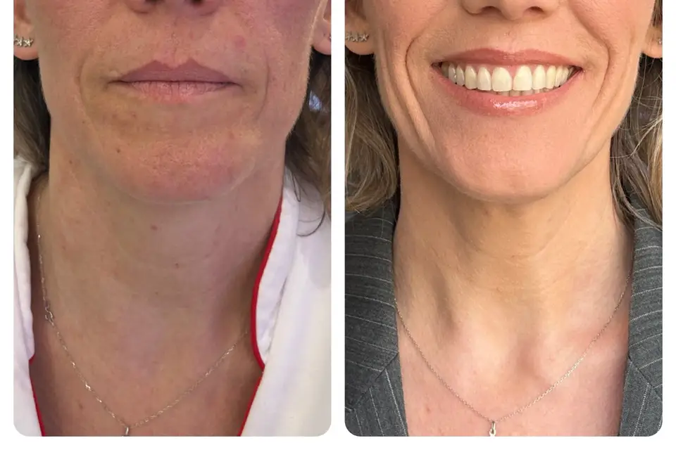 Sophie Guinot Hyeres — photo 4