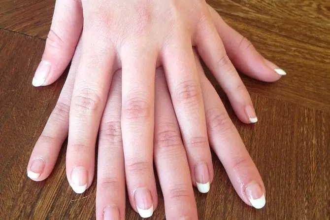 Ongles Fantaisies — photo 4