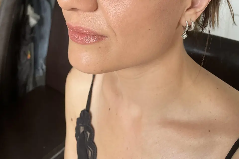 Fio’Estetica — photo 2