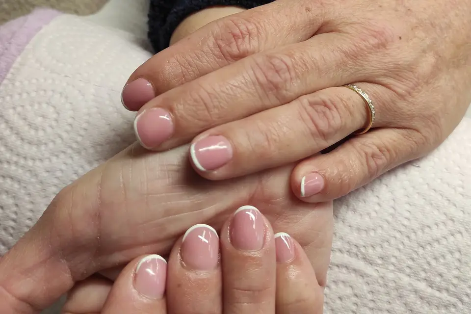 Onglemany — photo 1