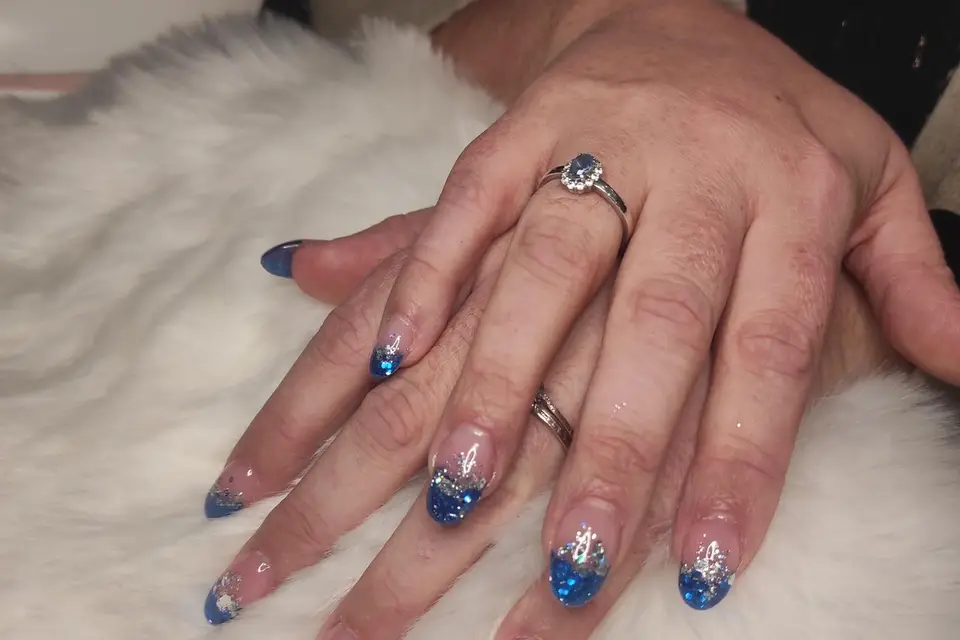 Onglemany — photo 2