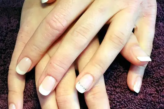 Chris a Lid — photo 7