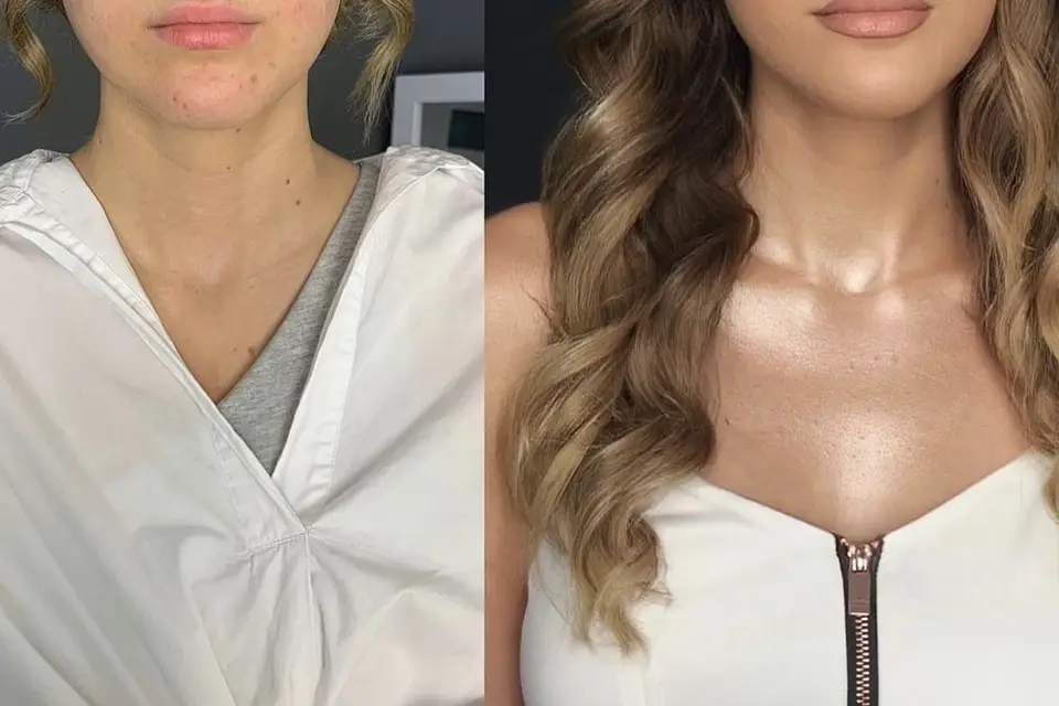 Artemisia — photo 4