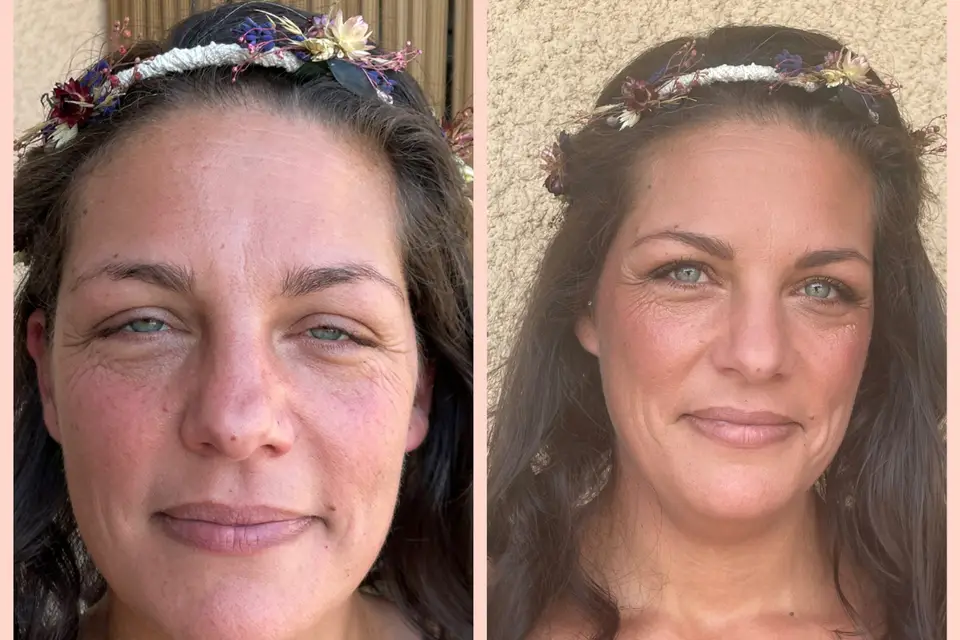 ASF Dermo — photo 4