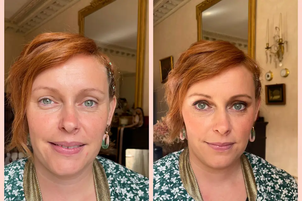 ASF Dermo — photo 7