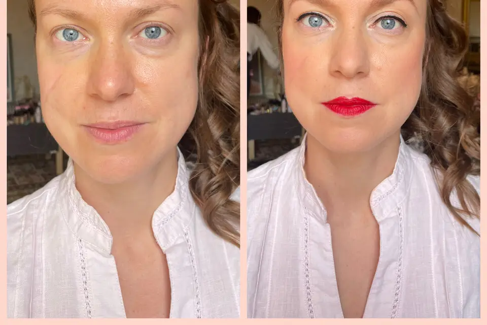 ASF Dermo — photo 5