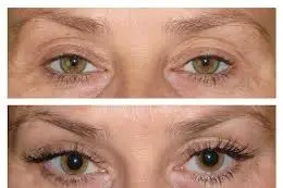 Jolibozongles - Beaune — photo 5